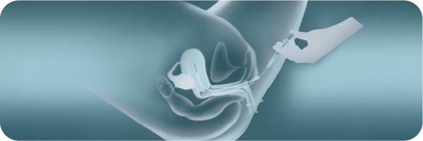 Inseminación